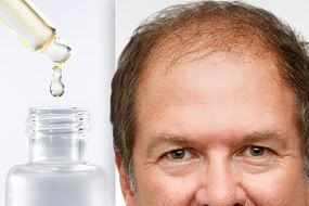View Baby Hair Growth Products
 Gif