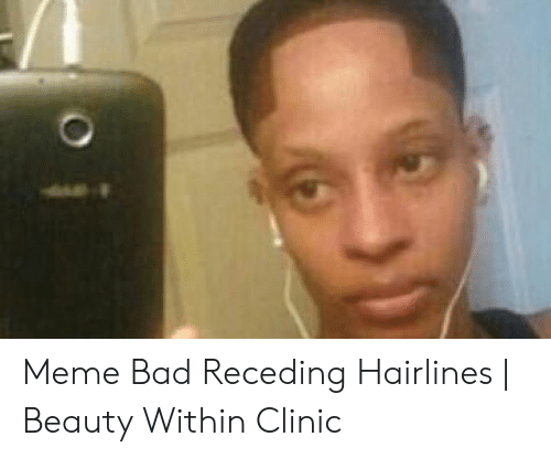 Bad Hairline Memes